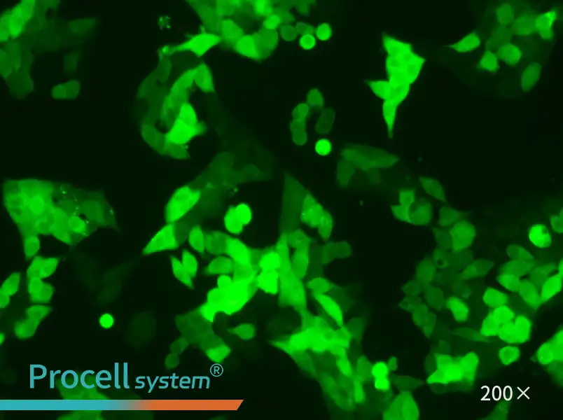SW620-GFP Cell Complete Medium - 5