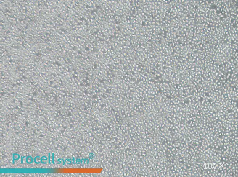 OCI-AML-3 Cell Complete Medium - 3