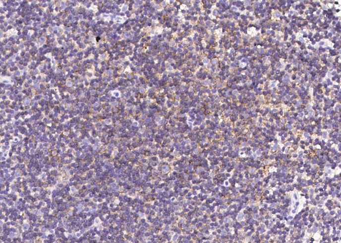 Recombinant CD150/SLAM/SLAMF1 Monoclonal Antibody - small - 2