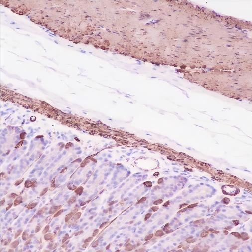 Recombinant alpha smooth muscle Actin Monoclonal Antibody - small - 5