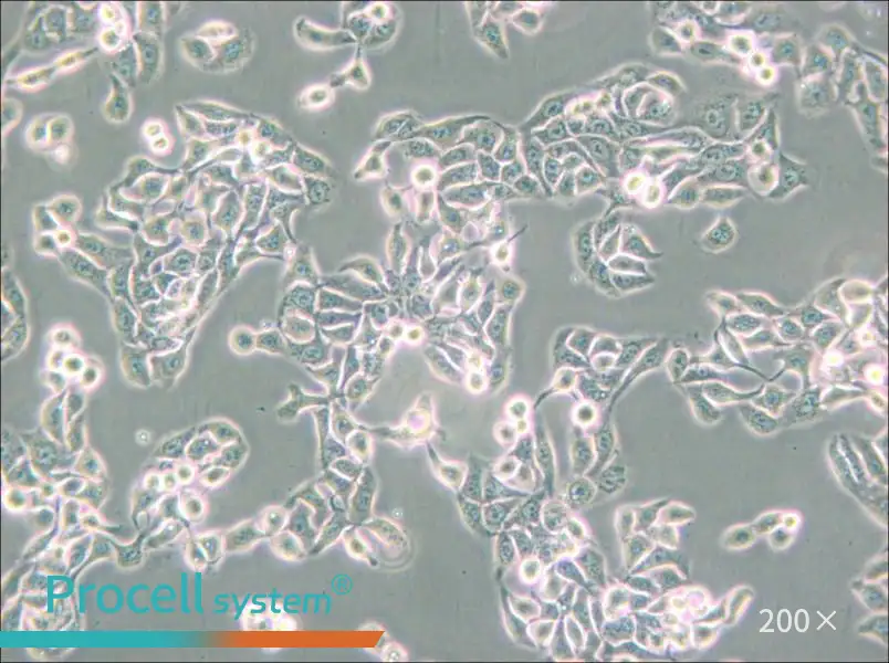 RT-112 Cell Complete Medium - small - 6