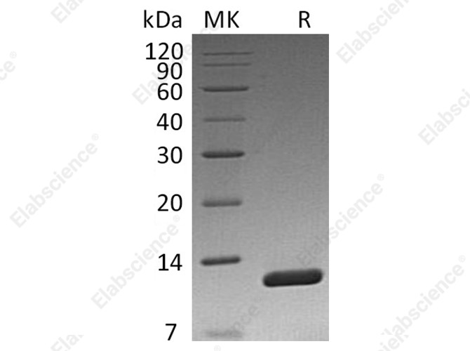 Recombinant Vibrio cholerae Toxin B Protein - 1