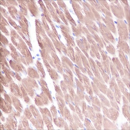 Recombinant Myosin Light Chain 3 Monoclonal Antibody - small - 5