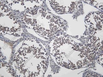 Recombinant SHLB1 Monoclonal Antibody - 2