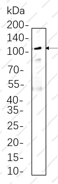 Recombinant MMP9 Monoclonal Antibody - 1