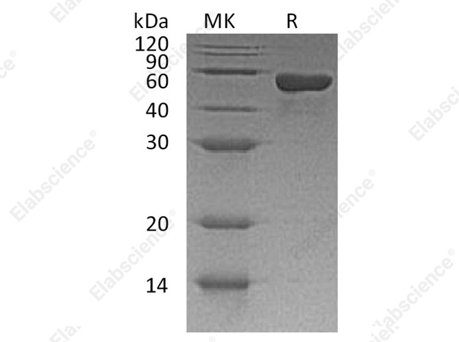 Recombinant Human CD4/LEU3 Protein (His Tag) - 1