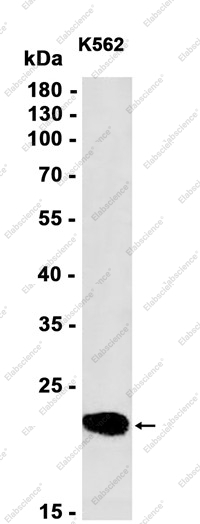 Recombinant Peroxiredoxin 2 Monoclonal Antibody - 1
