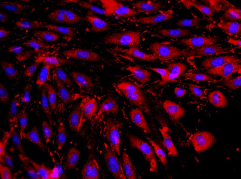 Rat Cardiac Microvascular Endothelial Cell Complete MediumRat Cardiac Microvascular Endothelial Cell Complete Medium - 2