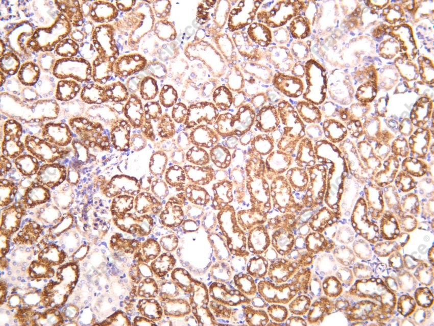 Recombinant SOD2 Monoclonal Antibody - 5