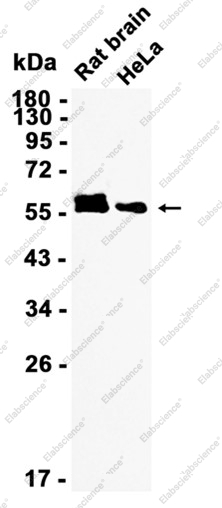 Recombinant CaMKII Monoclonal Antibody - 2