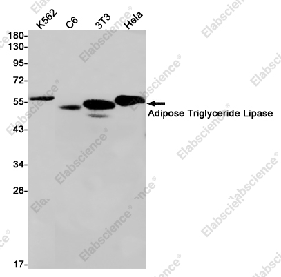 Recombinant Adipose Triglyceride Lipase Monoclonal Antibody - 1