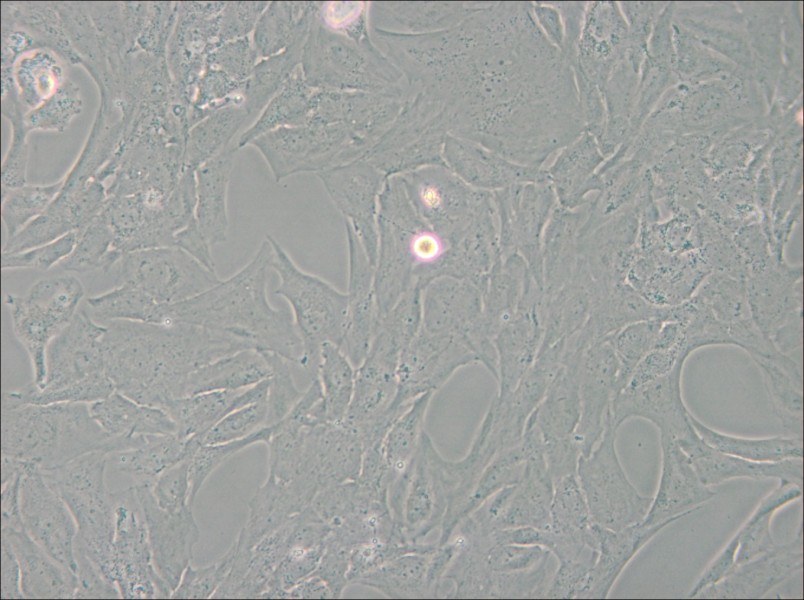 NCI-H196 Cell Complete Medium - small - 5