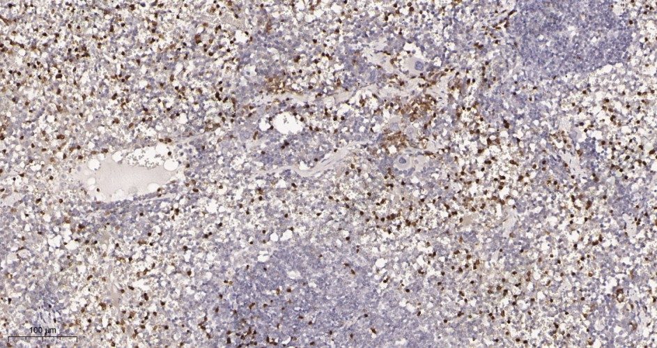 Recombinant Ctip2 Monoclonal Antibody - 3