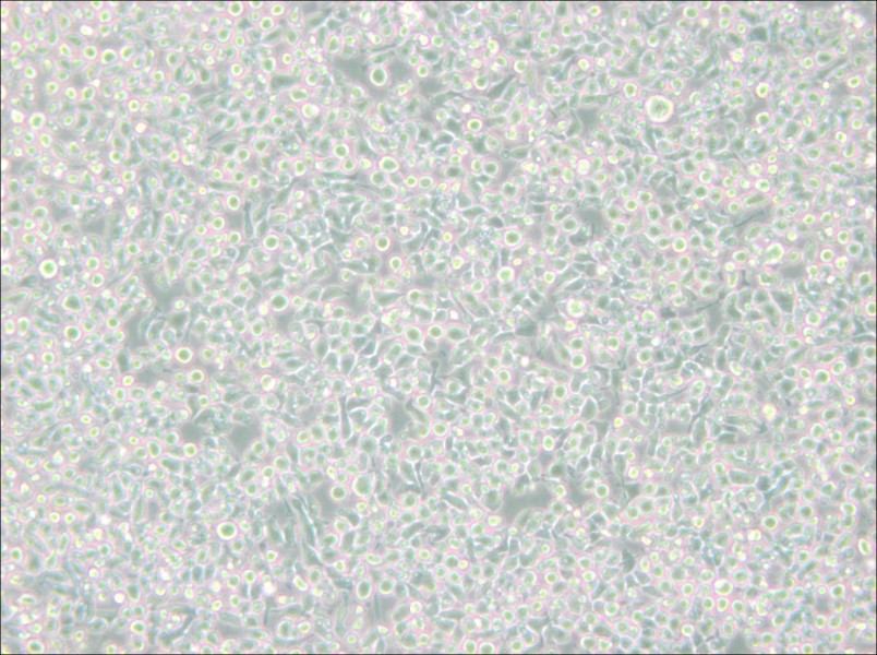 MM.1S Cell Complete MediumMM.1S Cell Complete Medium - 2