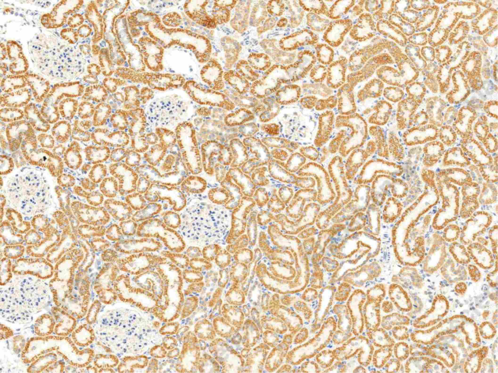 Recombinant Thioredoxin-2/TXN2 Monoclonal Antibody - 3
