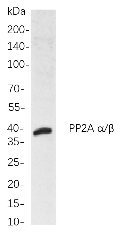 Recombinant PP2A α/β Monoclonal Antibody-searchlist-1