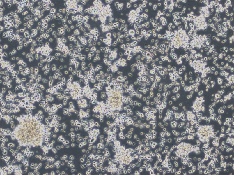 HCC38 BL Cell Complete Medium - 3