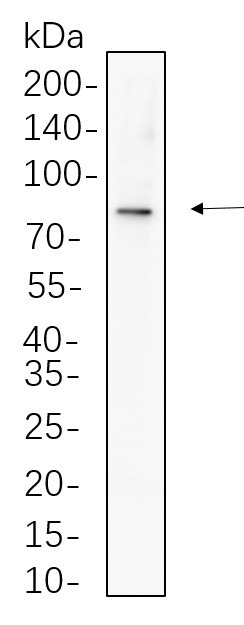 Recombinant Phospho-β Catenin (Ser675) Monoclonal Antibody-searchlist-1