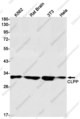 Recombinant CLPP Monoclonal Antibody - 1
