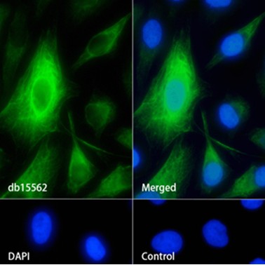 Recombinant Cytokeratin 7/KRT7 Monoclonal Antibody - 2
