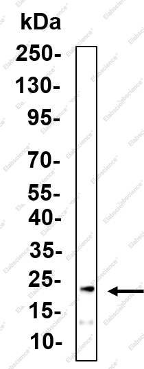 Recombinant Rab 10 Monoclonal Antibody - 1