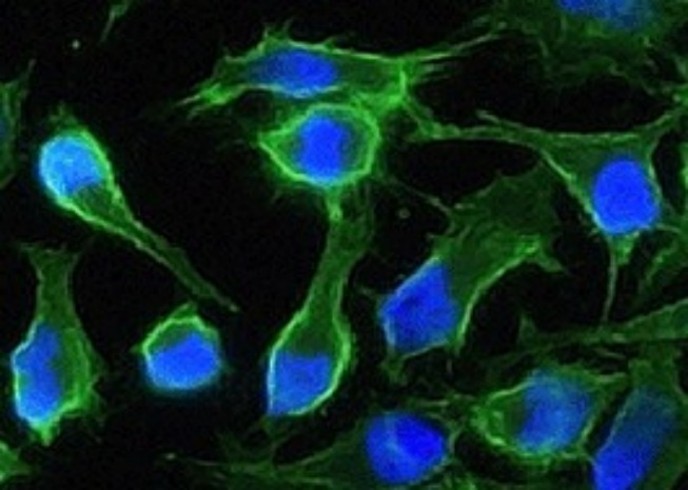 Recombinant CD147/EMMPRIN/Basigin Monoclonal Antibody - small - 2