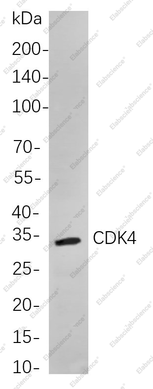 Recombinant CDK4 Monoclonal Antibody - 1
