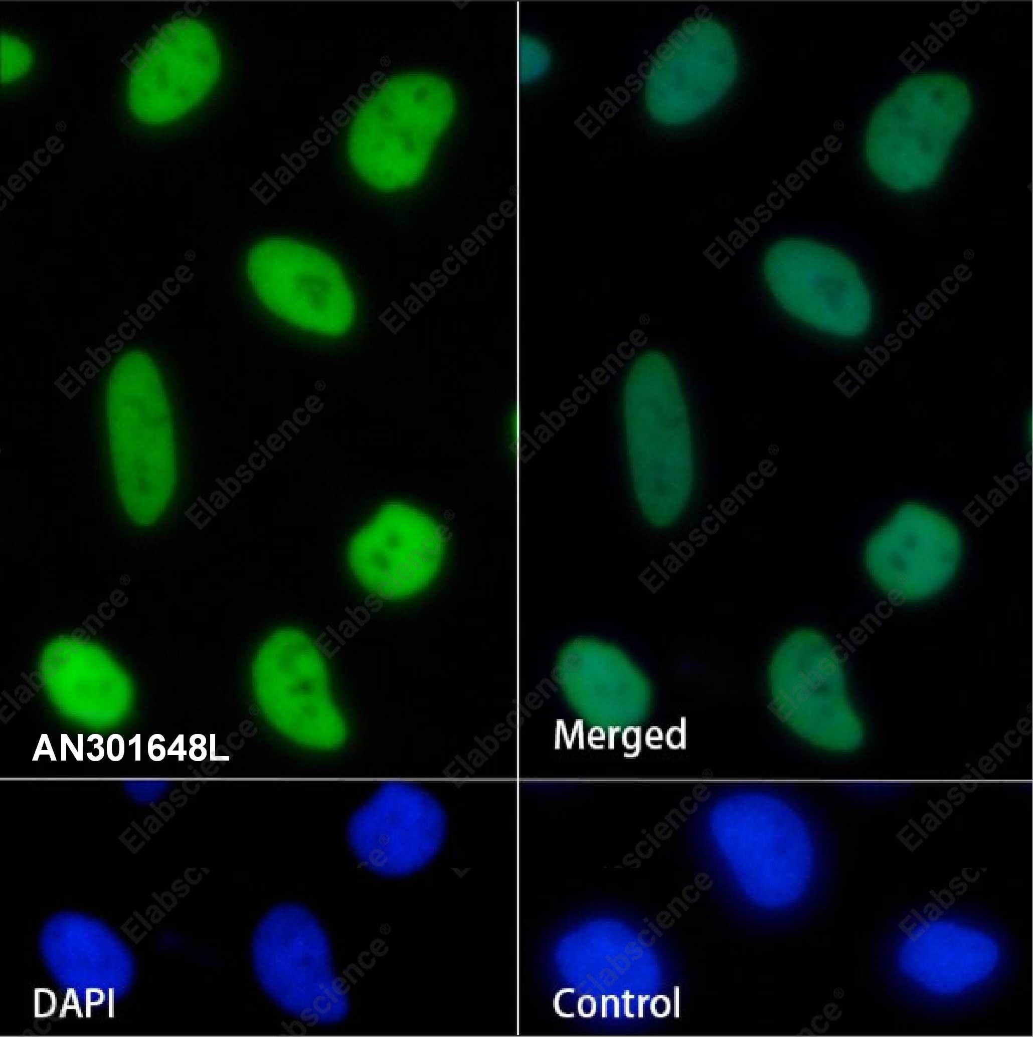 Recombinant RBBP4 Monoclonal Antibody - 4