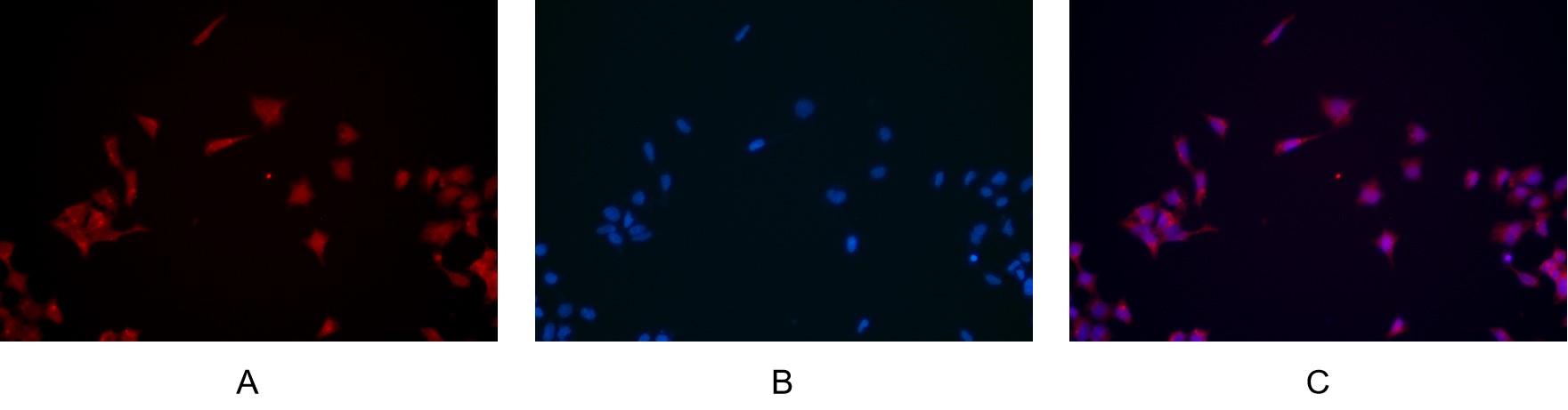 Recombinant NF-κB p65 Monoclonal Antibody - small - 5