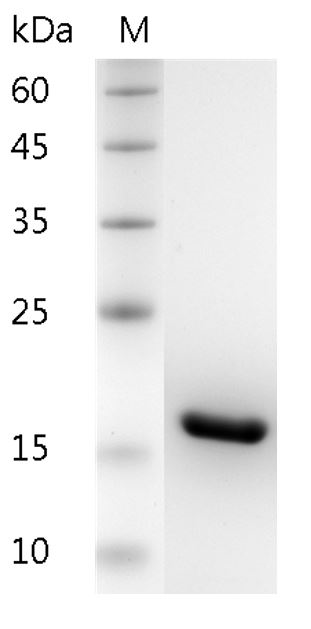Recombinant Human IL-1 beta/IL1B Protein-searchlist-1