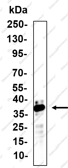 Recombinant DAZL Monoclonal Antibody - 1