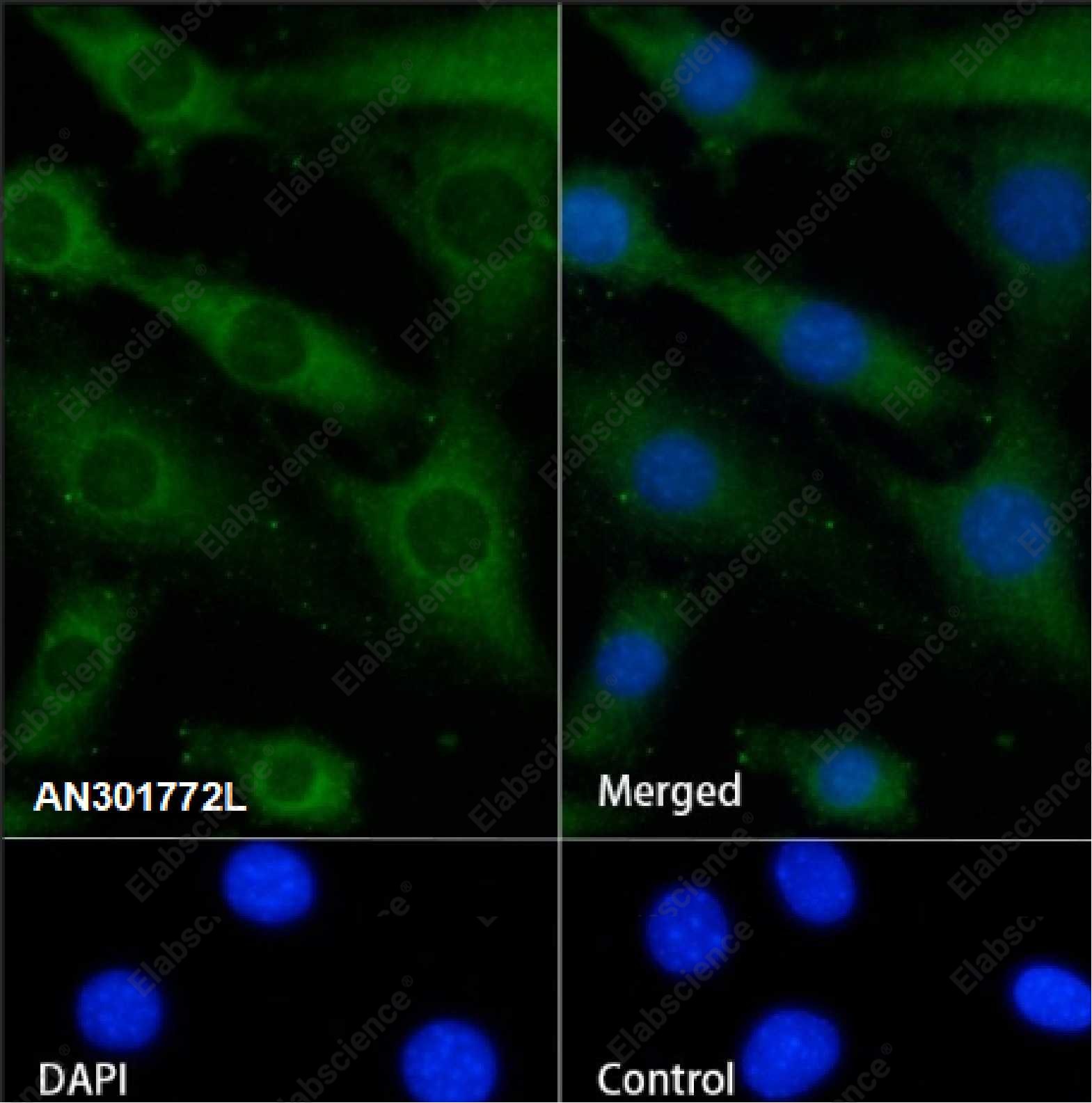 Recombinant RPL26L1 Monoclonal Antibody - 2