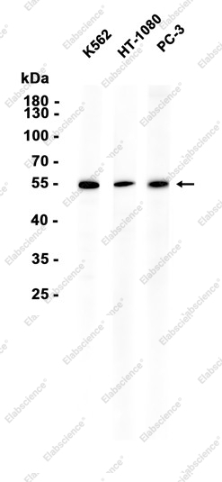 Recombinant Nampt Monoclonal Antibody - 1