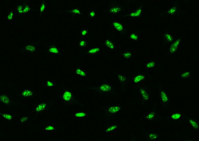 Ki67/MKI67 Monoclonal Antibody - small - 3