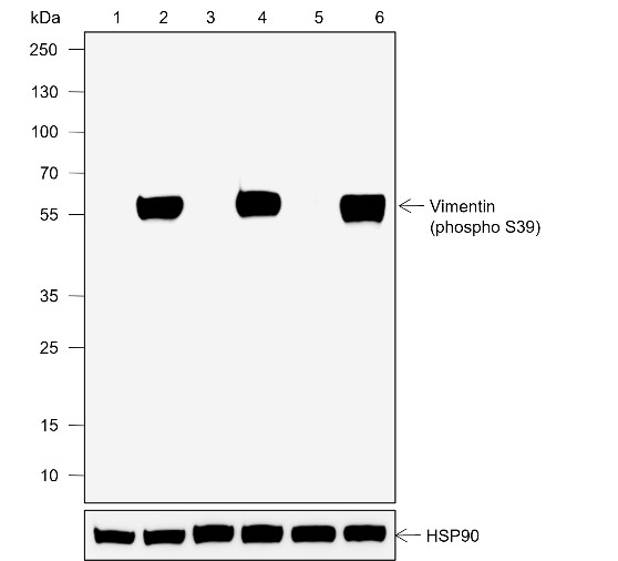 Recombinant Phospho-Vimentin (Ser39) Monoclonal Antibody-searchlist-1