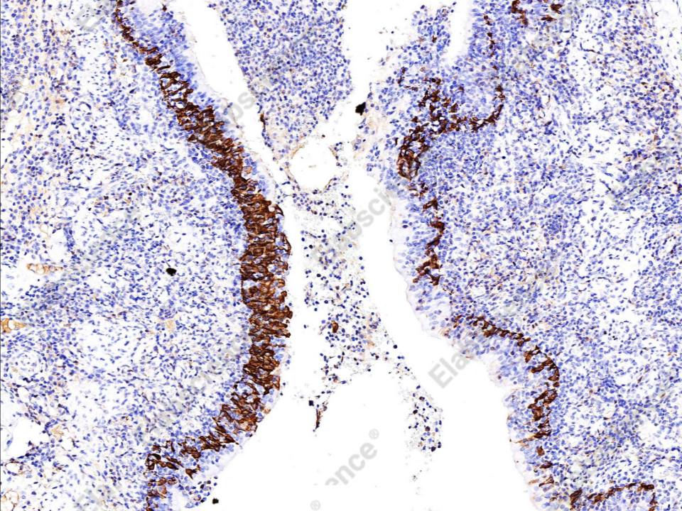 Recombinant Cytokeratin 5/KRT5 Monoclonal Antibody - 2
