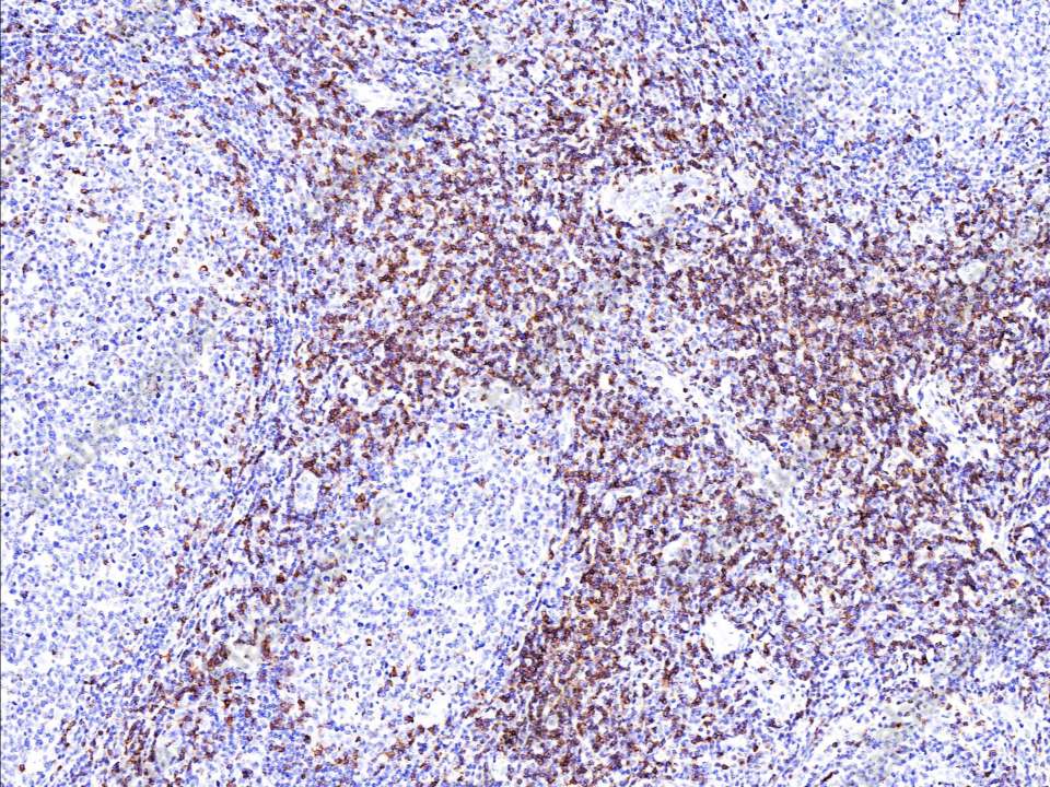 Recombinant CD7 Monoclonal Antibody - 1