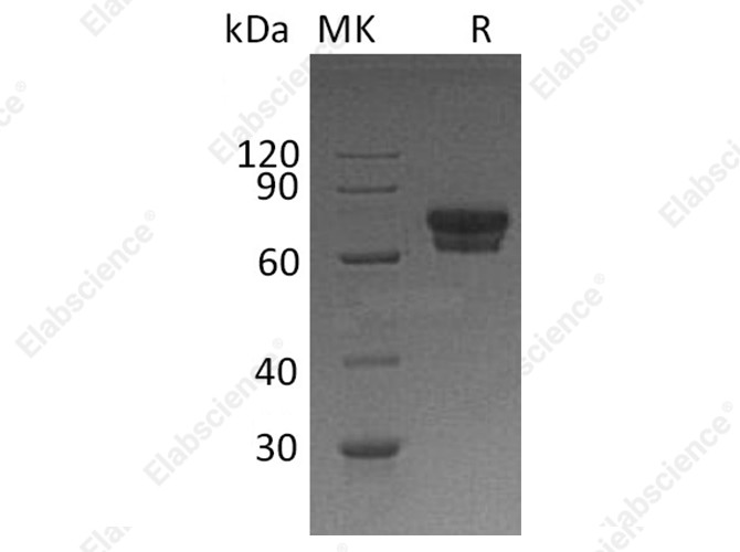Recombinant Human IL2Ra/CD25 Protein (Fc Tag) - 1