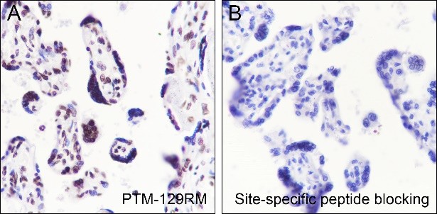 Recombinant Histone H3 (Acetyl Lys64) Monoclonal Antibody - small - 3