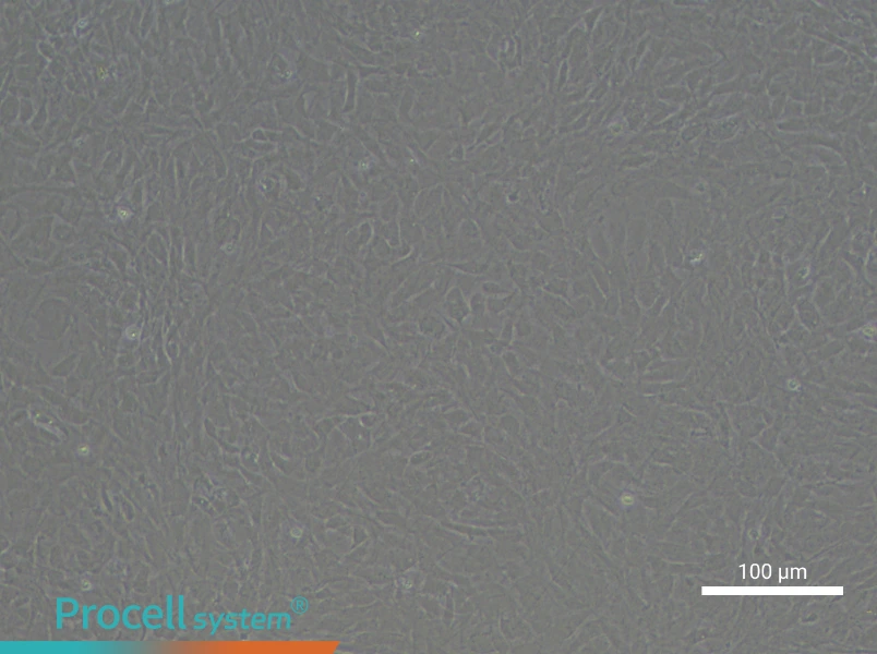 Rat Bronchial Fibroblast Complete Medium - 2