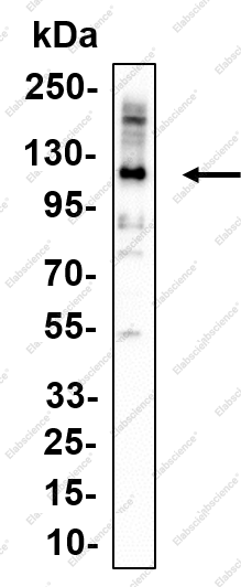 Recombinant eEF2K Monoclonal Antibody - 1