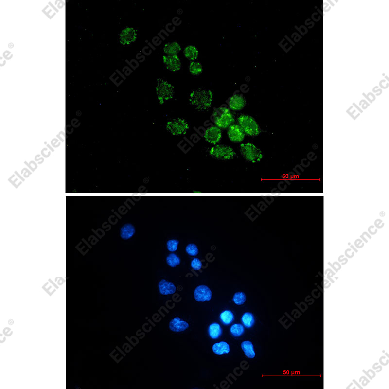 Recombinant PUS1 Monoclonal Antibody - 2
