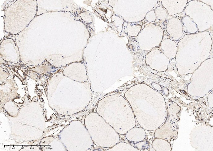 Recombinant Vimentin Monoclonal Antibody - small - 2