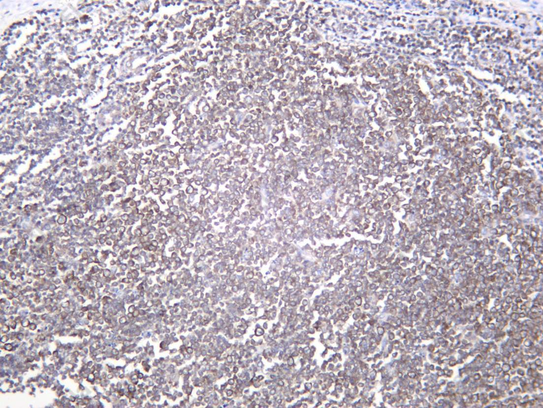 Recombinant STIP1/HOP Monoclonal Antibody - 2