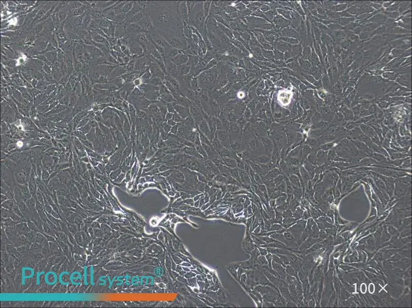 NCI-H2444 Cell Complete Medium - 1