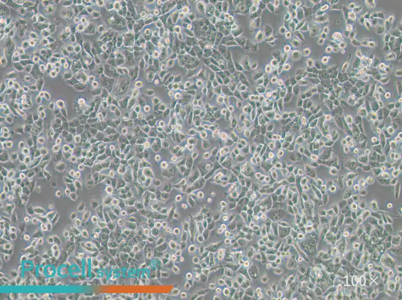 NPC/HK1 Cell Complete Medium - 2