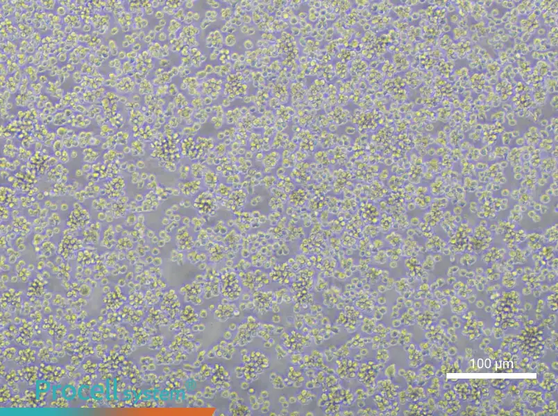 Karpas-422 Cell Complete MediumKarpas-422 Cell Complete Medium - 1