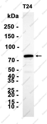 Recombinant PFKL Monoclonal Antibody - 2