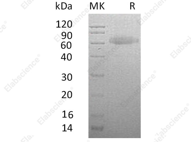 Recombinant Human RSPO3 Protein (Fc & His Tag) - 1