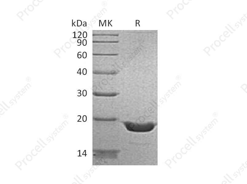 TNF-&alpha;/TNFA/TNFSF2 (N-6His), Human, Recombinant